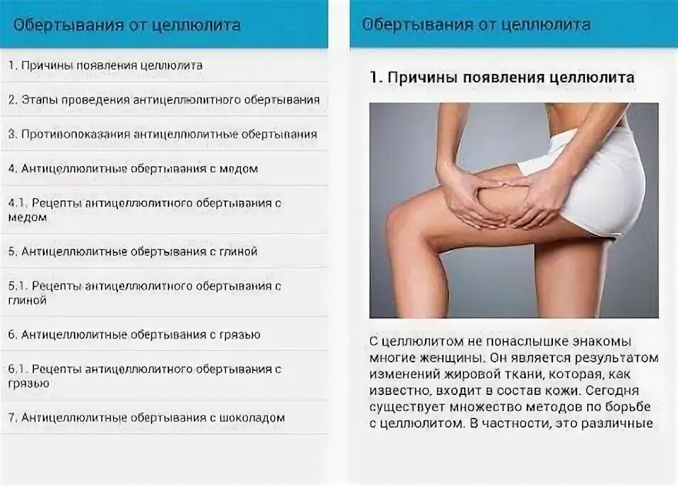 Почему появляется целлюлит. Причины появления целлюлита. целлюлит причины возникновения. причины целлюлита у женщин.