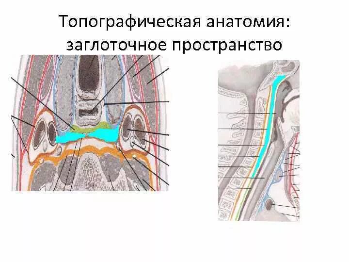 Spatium retropharyngeum. Окологлоточное пространство и заглоточное пространство. Флегмона заглоточного пространства. Абсцесс окологлоточного пространства. Заглоточное клетчаточные пространства.