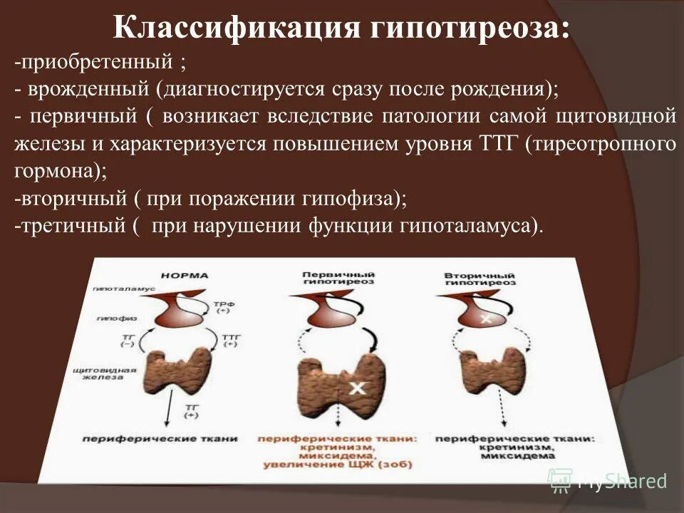 Щитовидная железа классификация. Зобогенный гипотиреоз. Гипотиреоз классификация. Классификация гипофункции щитовидной железы. Гипотиреоз презентация.