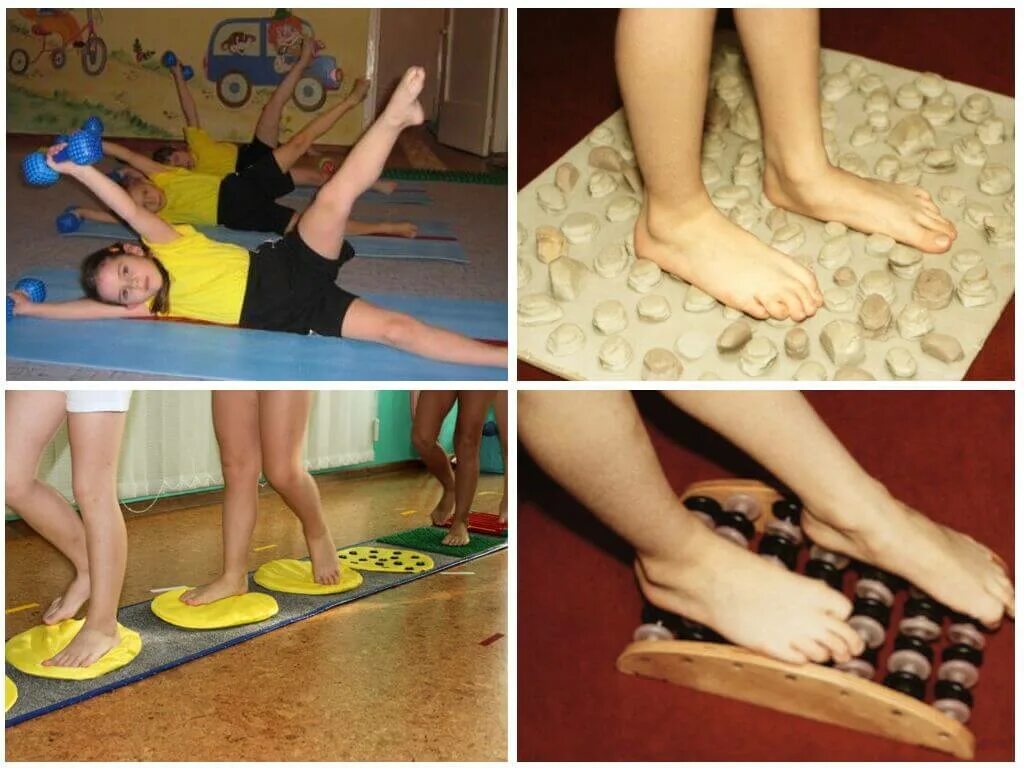 плоскостопие упражнения видео. упражнения для стоп от плоскостопия. плоскостопие упражнения видео. гимнастика для стопы при плоскостопии у детей. плоскостопие упражнения видео.