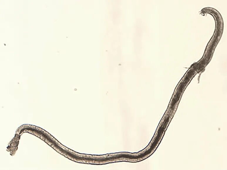 Angiostrongylus cantonensis слизняк. Angiostrongylus cantonensis у человека. Angiostrongylus cantonensis слизняк. Паразит angiostrongylus cantonensis. Ангиостронгилез у человека симптомы.