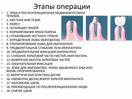 Перечислите этапы операции
