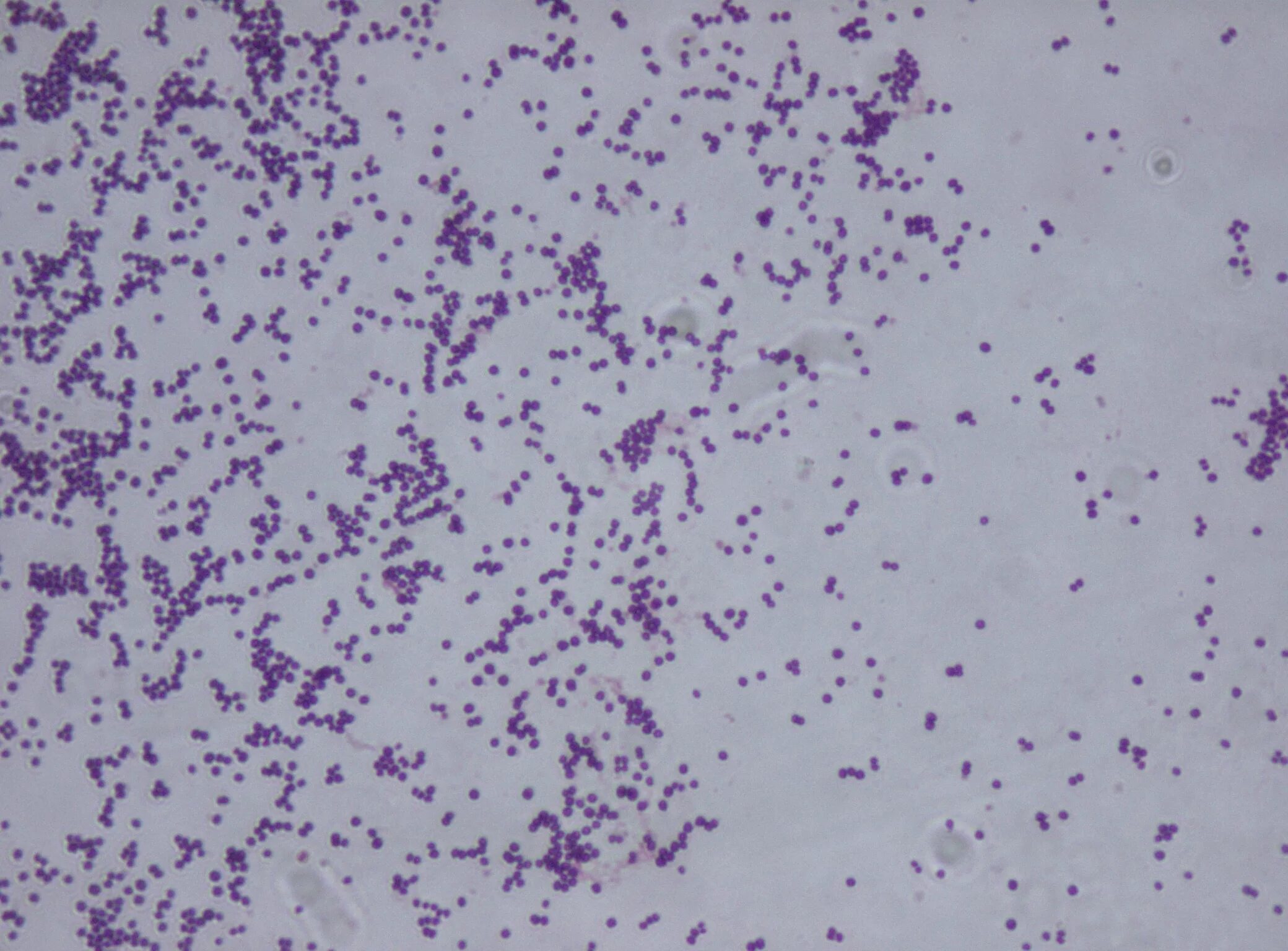Staphylococcus aureus 5. Сапрофический стафилококк. Стафилококк сапрофитус. Стафилококк сапрофитный микроскопом. Стафилококк ауреус микроскопия.