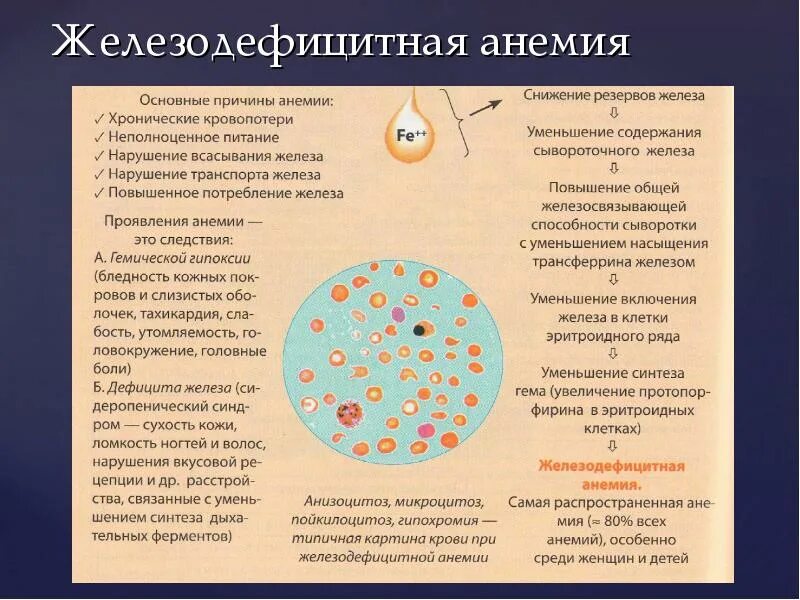 Малокровие эритроцитов. Анизоцитоз микроцитоз анемия. Жда микроцитоз пойкилоцитоз. Гемограмма крови при железодефицитной анемии. Анизоцитоз и пойкилоцитоз при анемии.