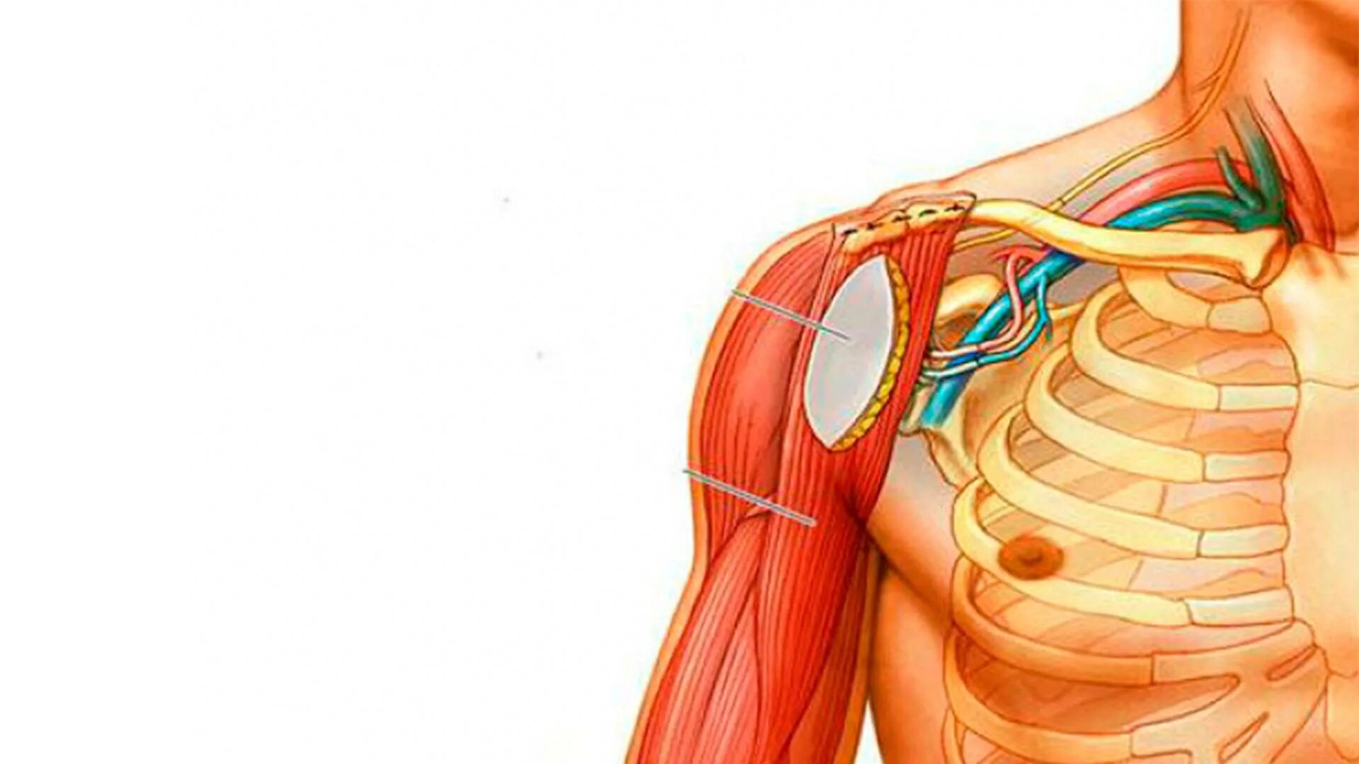Плексит локтевого сустава. Плексит неврит плечевого нерва. Плечевое сплетение иннервация руки. Плексопатия плечевого нерва. Локтевой нерв функции иннервация.