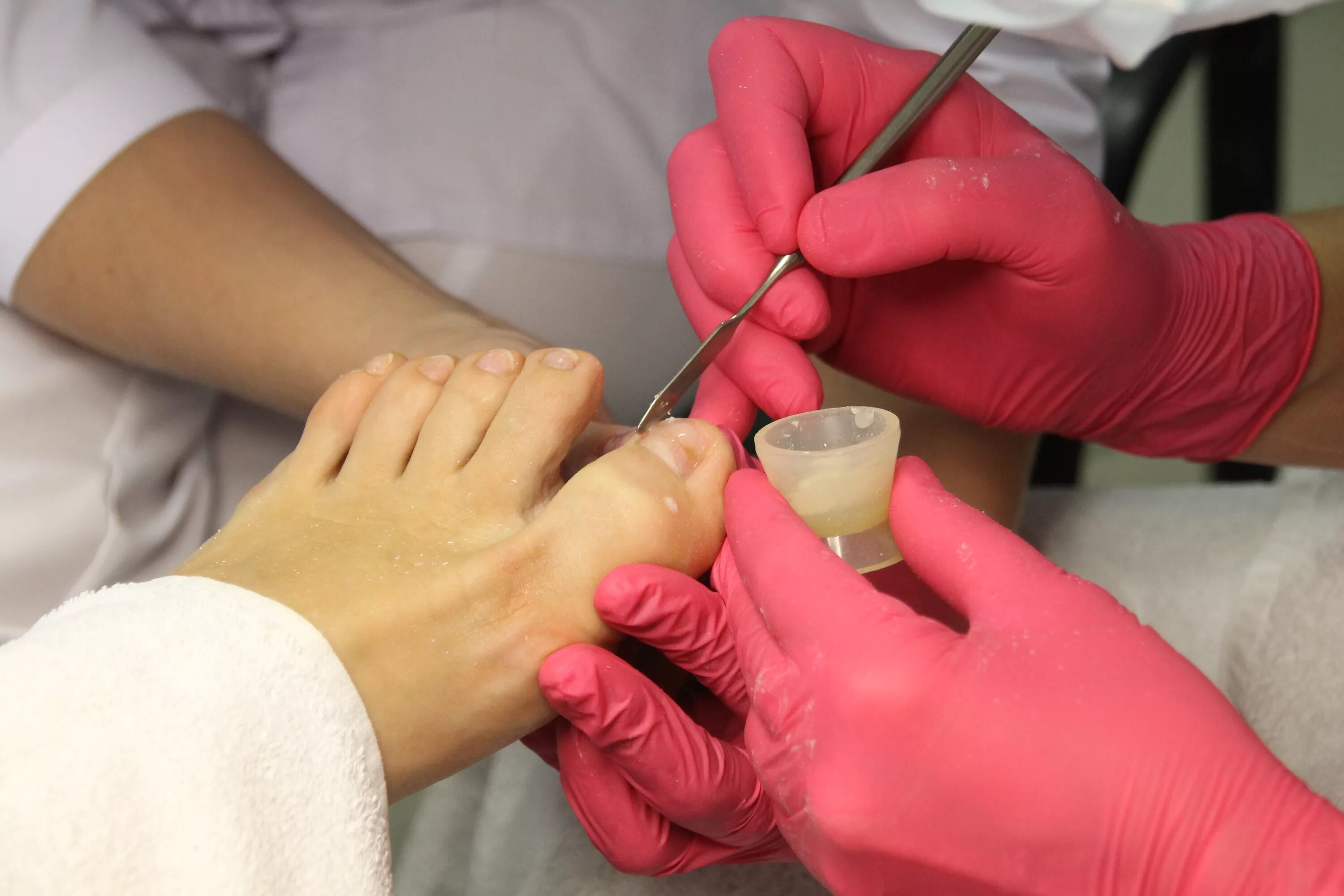 подолог ногти на руках