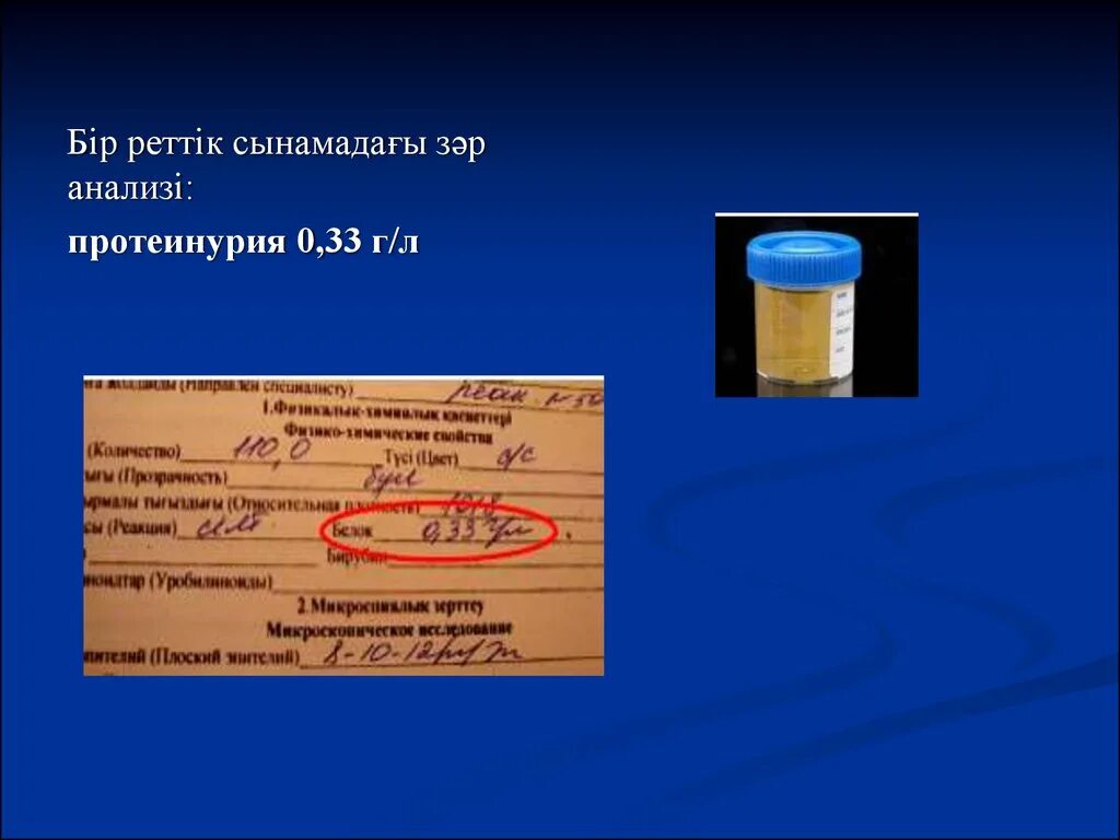 Исследование мочи протеинурия. Моча на суточную протеинурию. Бланк на суточную протеинурию. Суточная протеинурия бланк анализа.