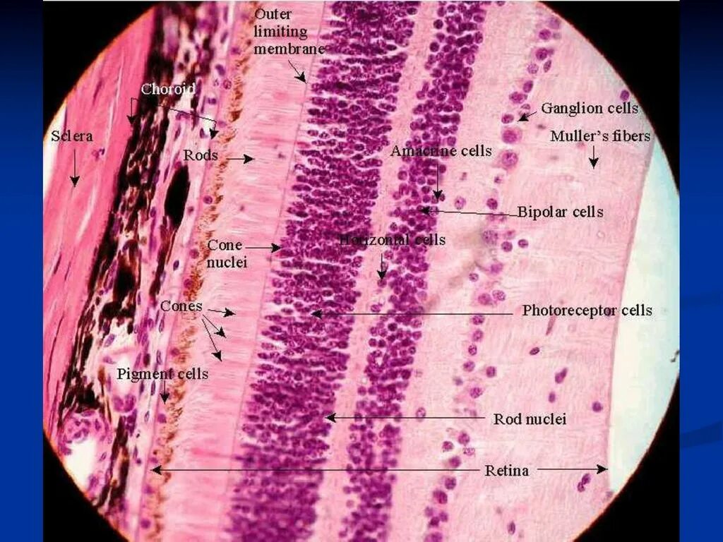 Задняя стенка глаза. Склера гистология препарат. Сетчатка гистология. Сетчатка гистология препарат. Строение сетчатки глаза гистология.