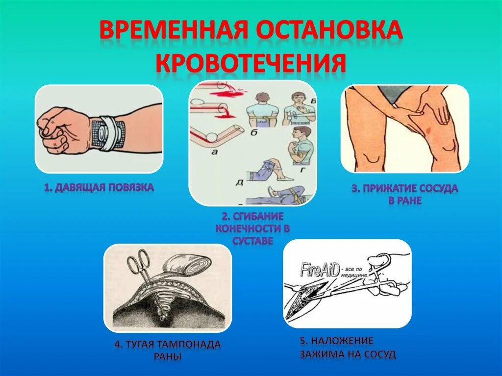 Временное кровотечение