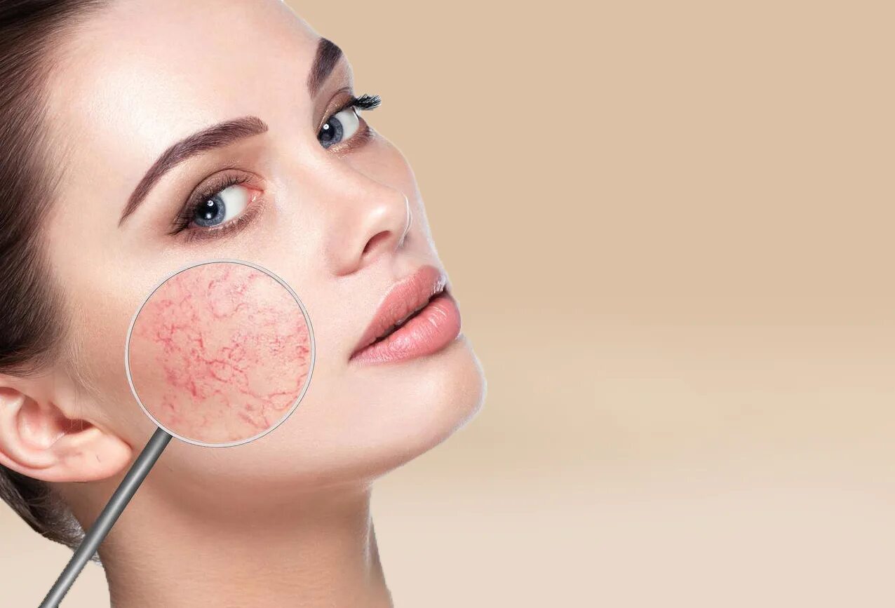 Омоложение сосудов