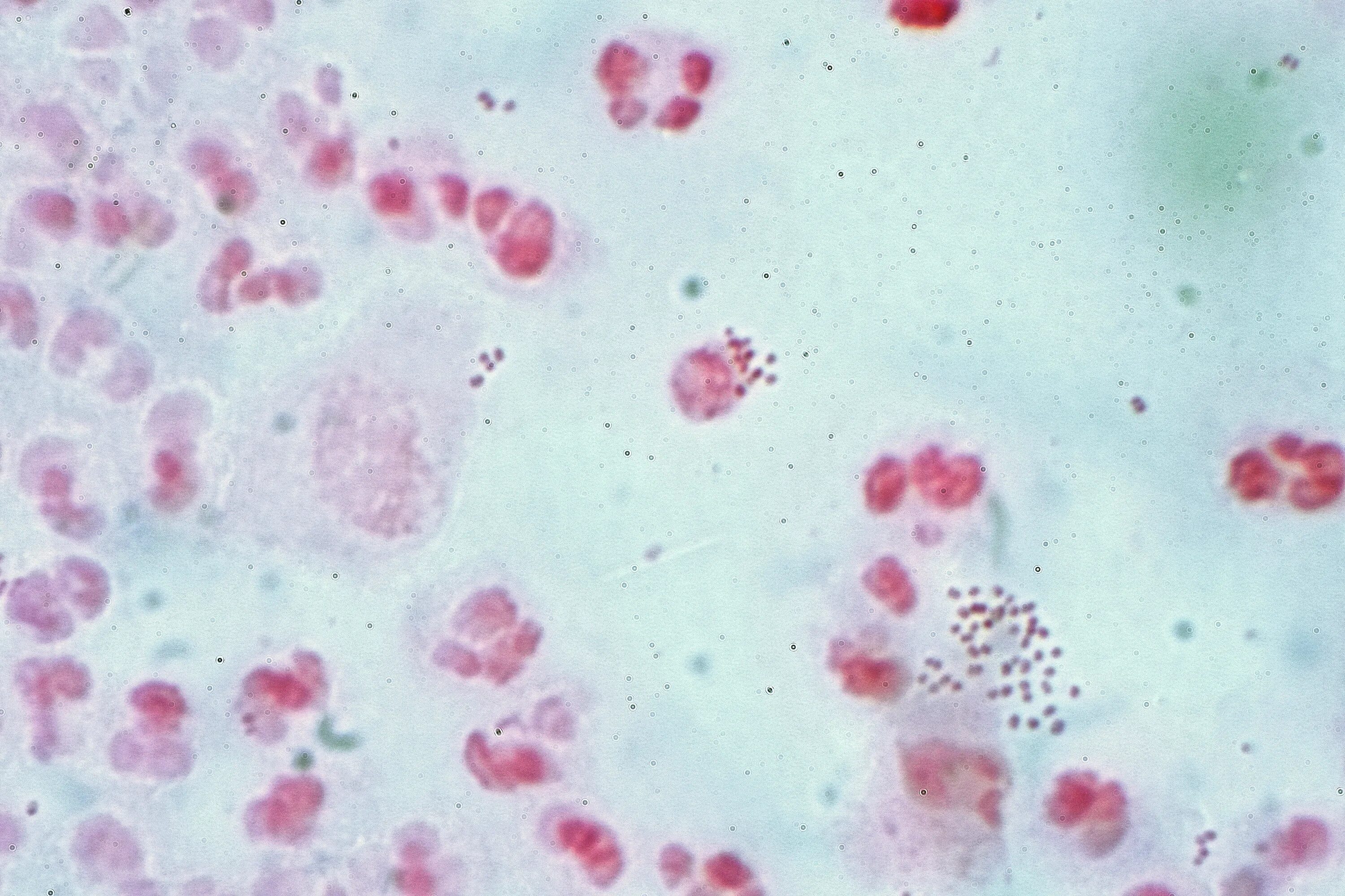 Chlamydia trachomatis neisseria gonorrhoeae. Нейссерия менингококк. Neisseria gonorrhoeae микроскопия.