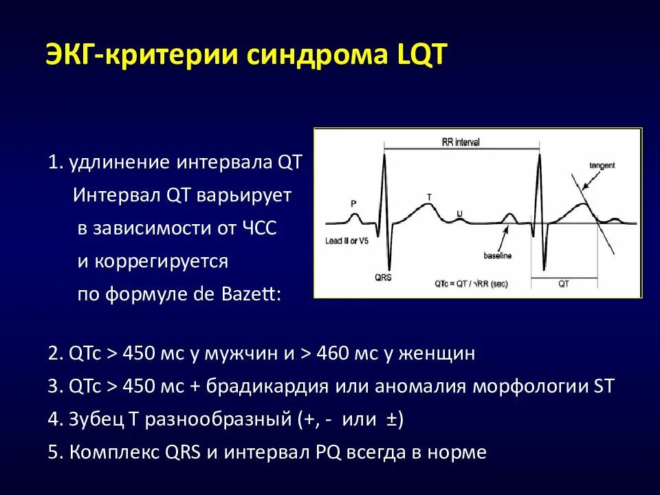 ЭКГ С синдромом удлиненного интервала qt у детей. ЭКГ показатель qt. Удлинение интервала qt на ЭКГ. Удлинённый интервал qt на ЭКГ. Удлиненное qt у ребенка