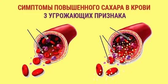 Сахар немного повышен. Повышение сахара в крови. Повышен сахар в крови. Симптомы высокого сахара в крови. Симптомы повышенной Глюкозы в крови.