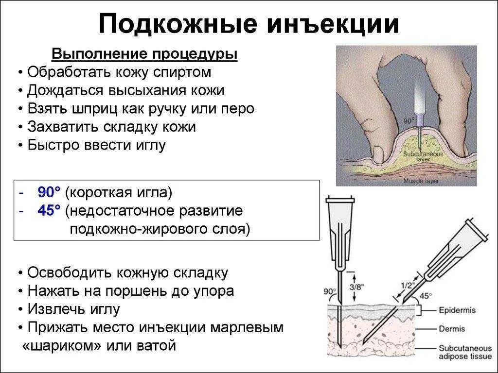 Как делать уколов