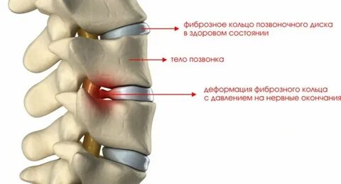 Шоп 2 степени