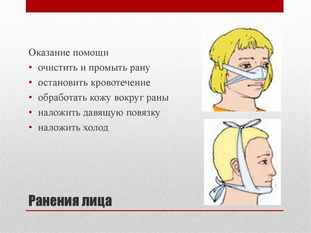 Повязка накладывается при повреждении затылка. Оказание первой помощи при носовом кровотечении. Оказание помощи при кровотечении из носа. Носовое кровотечение повязка. Оказание ПМП при носовом кровотечении.