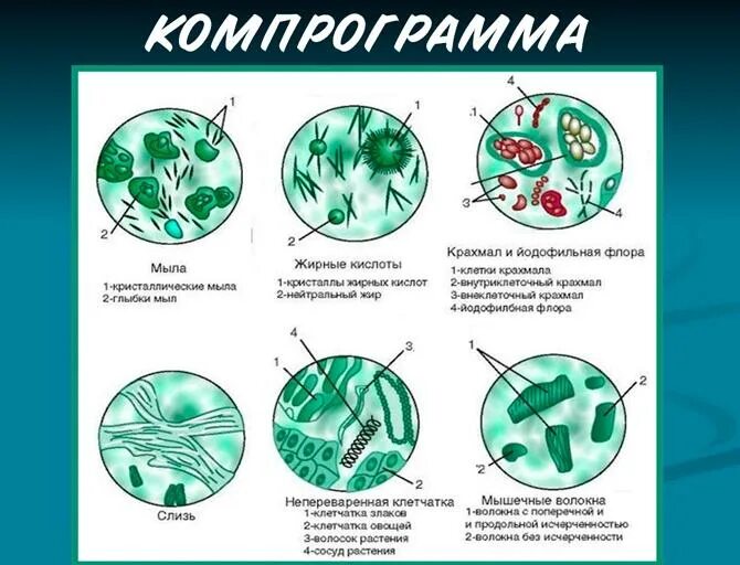 Микроскопическое исследование кала. Копрология кала микроскопия. Копрограмма микроскопическое исследование. Общеклиническое исследование кала копрограмма.