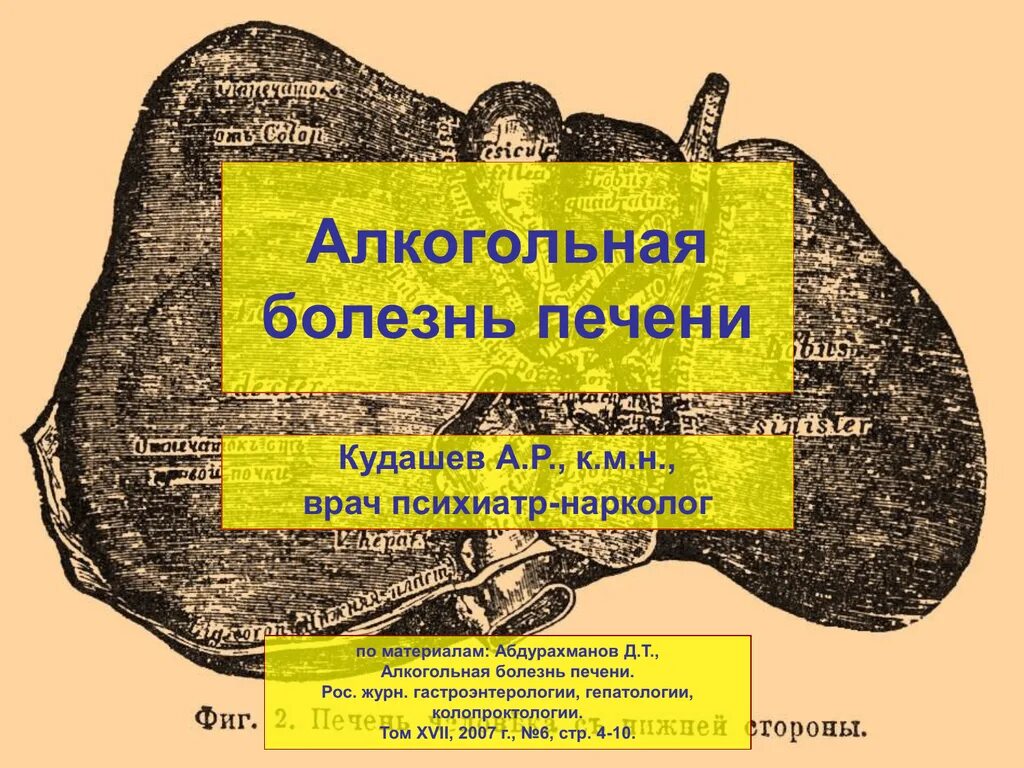 Дифференциальный диагноз неалкогольной жировой болезни печени. Алкогольная жировая болезнь печени. Цирроз печени клинические рекомендации 2021. Патогенез алкогольной болезни печени. Алкогольная болезнь печени клинические рекомендации ответы.