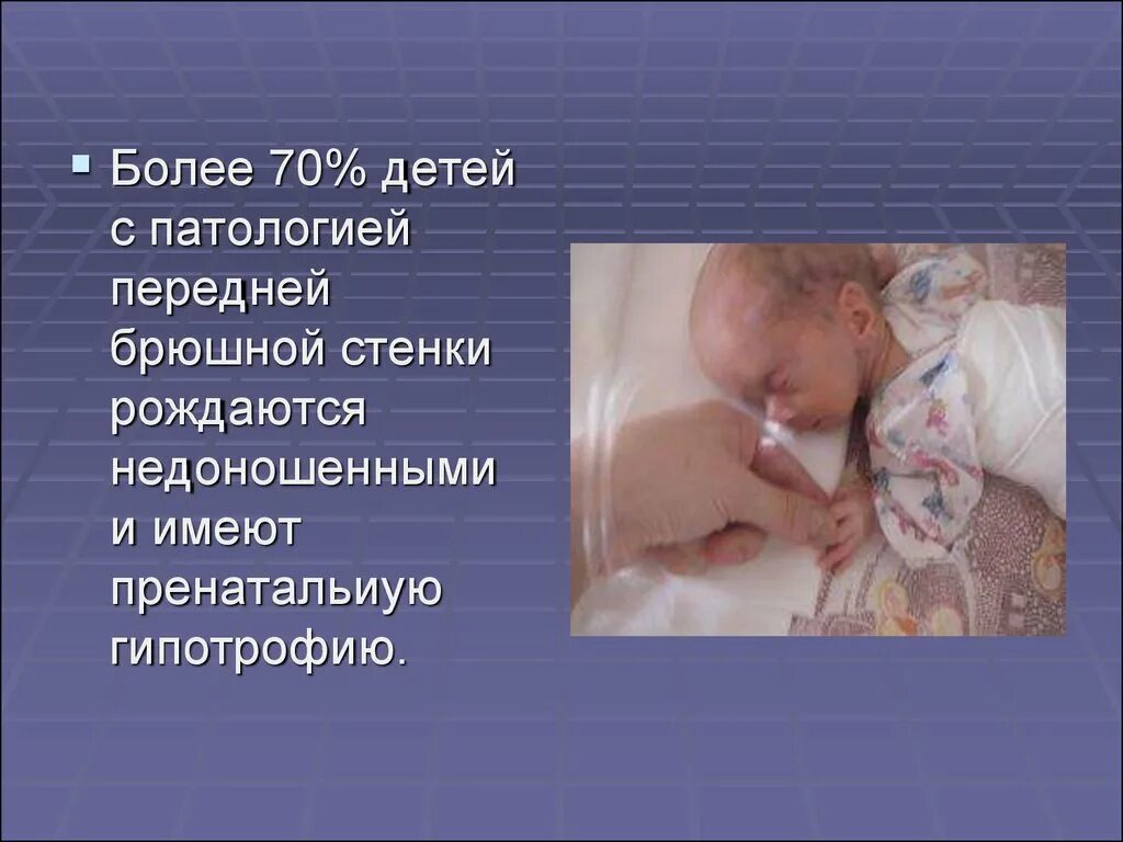 Врожденные патологии у детей. Фетопатия новорожденных. Патология это ребенка. Врожденные пороки новорожденных. Роль наследственных факторов возникновения речевых расстройств.