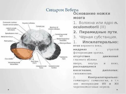 Симптом вебера