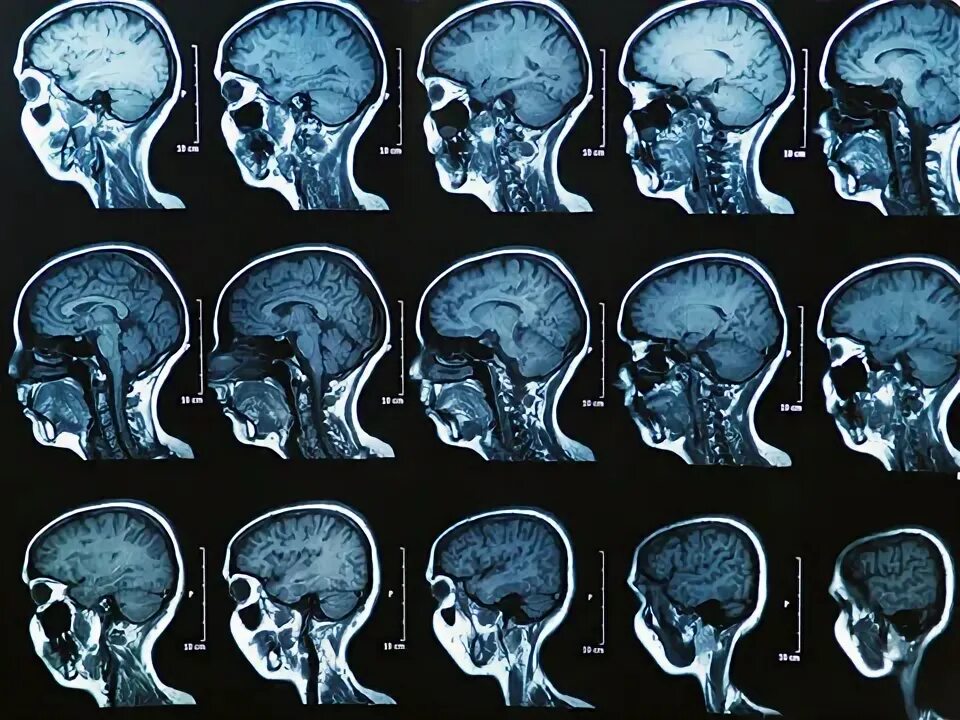 Patient in coma for 15 years shows signs of life after breakthrough