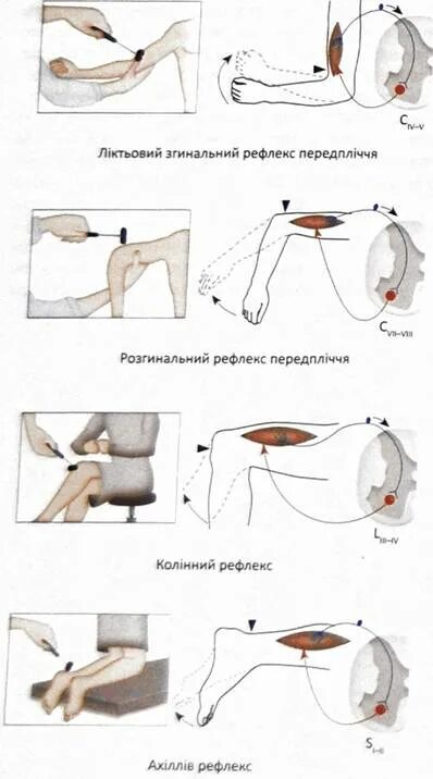 Рефлексы верхних конечностей. Сухожильные рефлексы конечностей. Асимметричные сухожильные рефлексы. Локтевой сгибательный рефлекс. Исследовать сухожильные рефлексы верхних конечностей.