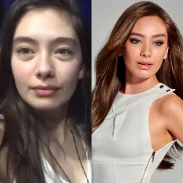 неслихан атагюль пластика. неслихан до и после пластики. неслихан атагюль до операции и после. неслихан до и после пластики. неслихан атагюль.