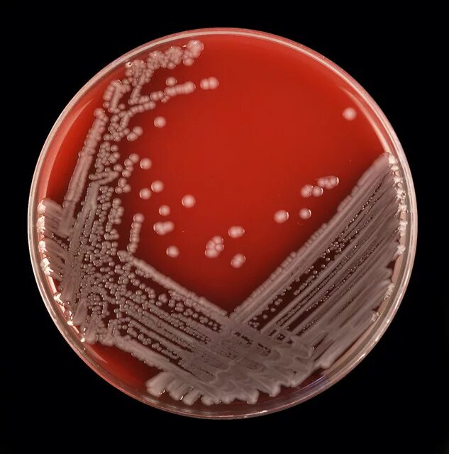 Staphylococcus e coli