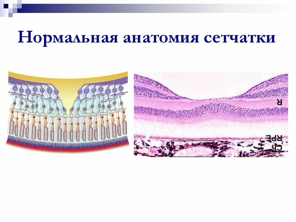 Пигментный эпителий глаза. Эпителий сетчатки глаза. Пигментированный эпителий сетчатки. Морфологии пигментного эпителия сетчатки.