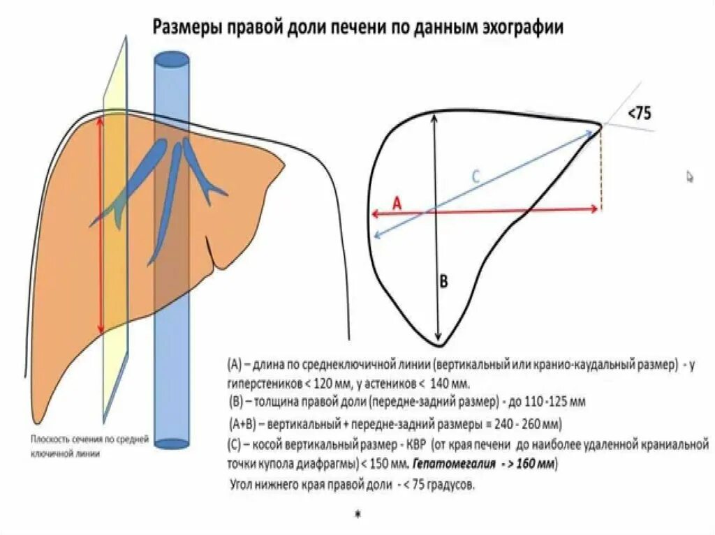 Размеры желчного пузыря у мужчин. Косой вертикальный размер правой доли печени на УЗИ. Размеры печени на УЗИ норма. Толщина правой доли печени в норме. Толщина правой доли печени на УЗИ норма.