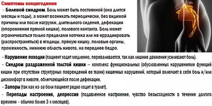 Симптомы кокцигодинии. Боли в копчике диагноз. Кокцигодиния рентген протокол. Боль в пояснице. Боли в копчике диагноз.