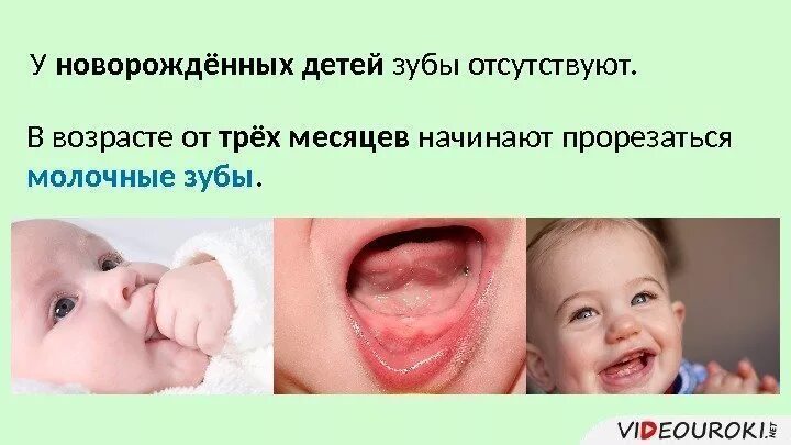 Зубы в 3 месяца какие. Как прорезаются зубы у грудничков. как выглядит прорезывающийся зуб. зубы в три месяца у ребенка.