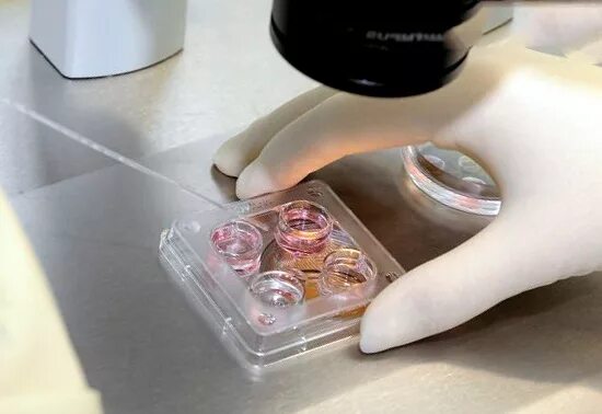 Перенос криоконсервированных эмбрионов. Криоконсервации эмбрионов. Криоконсервация 2 эмбрионов. Подсадка замороженных эмбрионов. Криоконсервация эмбрионов животных.