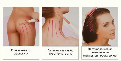Как делать массаж дарсонвалем