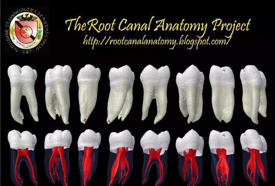 Анатомия корневых каналов зубов. Устья корневых каналов зубов. Формы корневых каналов