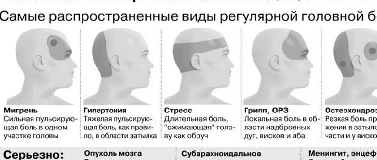 Сильная боль лобной. Головная боль локализация. Болит задняя часть головы затылок.