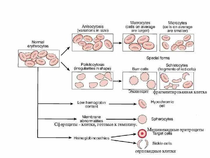 Эхиноциты. Сфероциты эритроциты. Мишеневидные эритроциты. Сфероциты клетки готовые. Эхиноциты эритроциты.