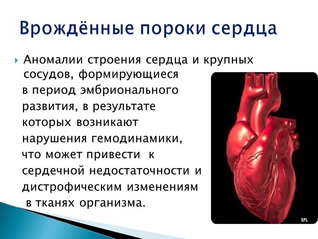 Врожденные аномалии приобретенные аномалии. Врожденные пороки сердца анатомия. ВРАЖДЕНЫЙ порог сердца. Врожденныепопроки сердца. Врожденный порог Серда.