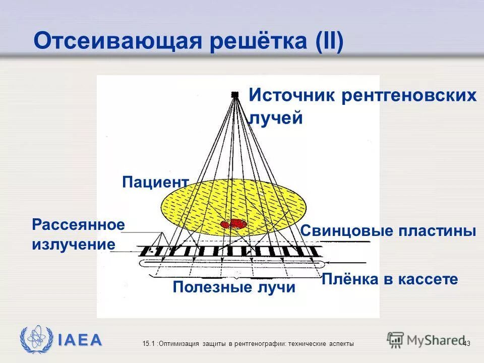 фильтрация и формирование пучка ри растры и отсеивающие решетки. отсеивающий растр в рентгенологии. решетка рентгеновская отсеивающая. отсеивающий растр. отсеивающий растр.