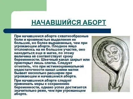 Сонник выкидыш во сне