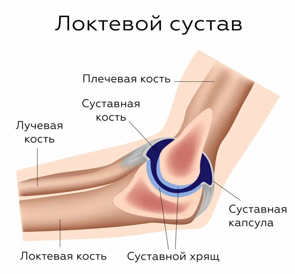 Связки локтя. Сумки локтевого сустава анатомия. Синовит локтевого сустава. Бурсы локтевого сустава анатомия. Артроз локтевого сустава.