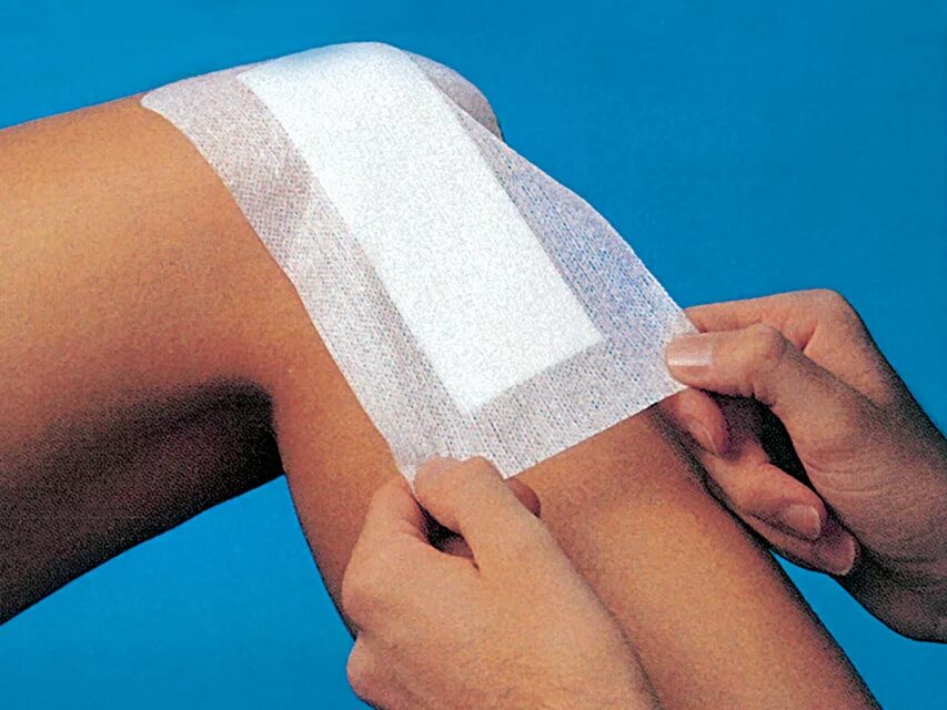 Где сделать перевязку после операции. Лейкопластырь 10х10 adhesive wound dressing. повязка адгезивная 10х8см медреспонс 5 шт. повязки для перевязки ран после операции. повязки медицинские адгезивные стерильные 10х35см.