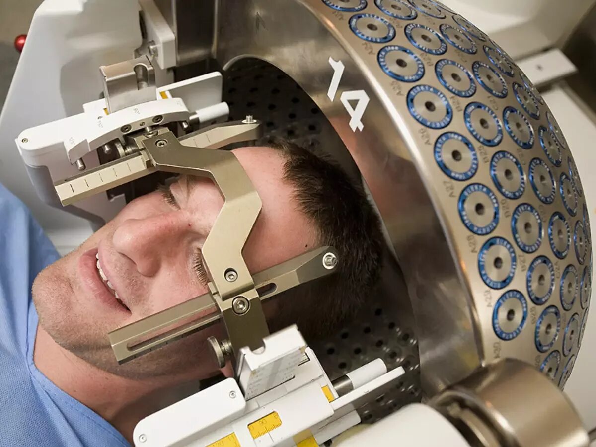Гамма нож метастаз. Гамма нож лекселла. радиохирургия гамма нож. гамма нож gamma knife. стереотаксическая радиохирургия гамма-нож.