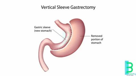 Procedure details