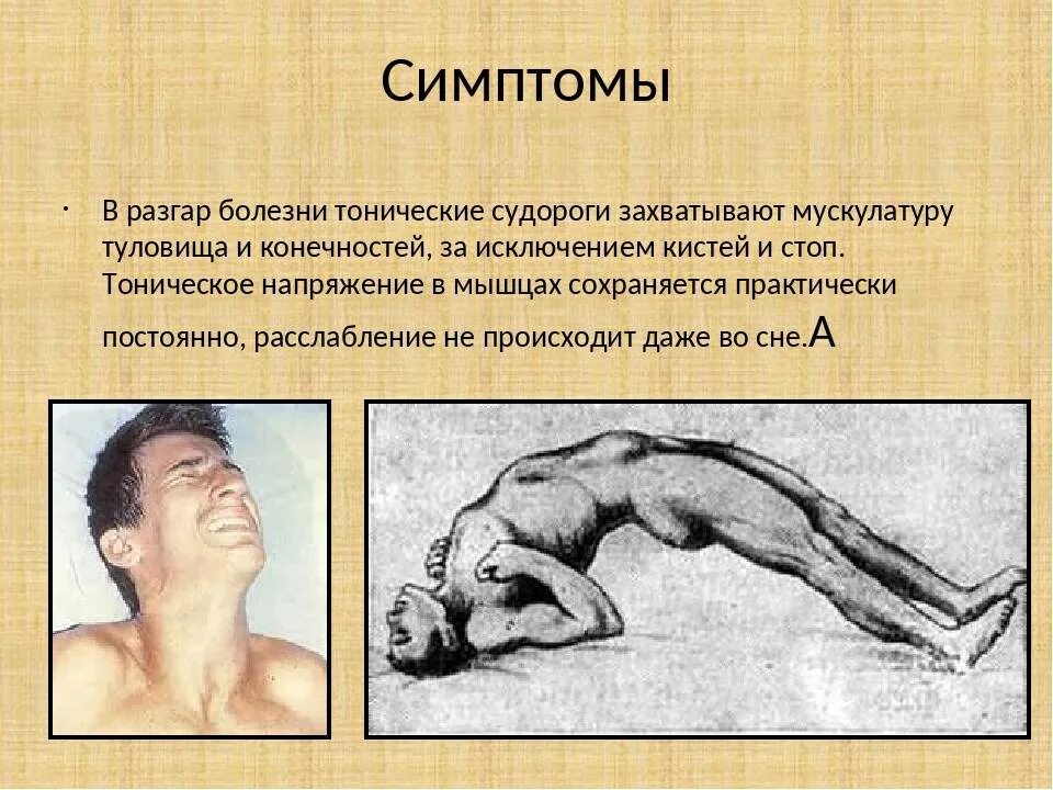 Вплоть симптом. Столбняк очаги поражения. первые симптомы столбняка.