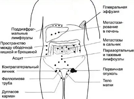 Где нащупать яичники у женщины