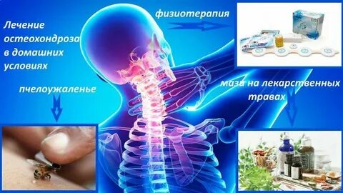 Медикаментозное лечение позвоночника