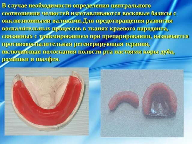 Привести в базисы. Восковые базисы с прикусными валиками. Окклюзионные валики. Восковой Базис с окклюзионными валиками. Изготовление воскового базиса с прикусными валиками.