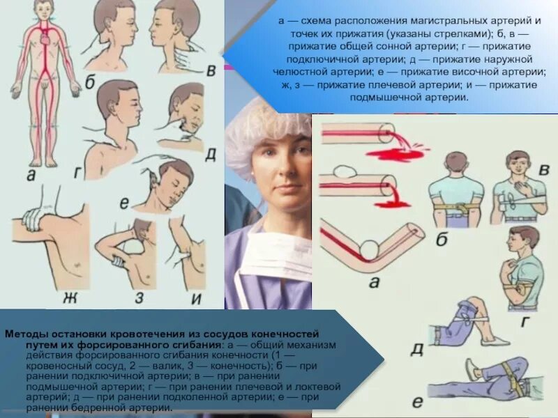 Первая помощь при ранении артерии. При ранении сонной артерии. при ранении сонной артерии необходимо. кровотечение из подключичной артерии. помощь при ранении сонной артерии.