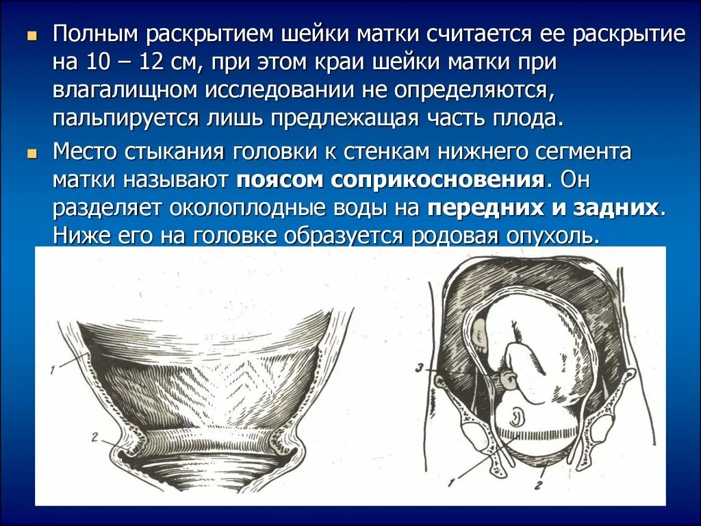 Шейка при родах сколько. Полное раскрытие шейки матки. Раскрытие шейки при родах. Этапы раскрытия шейки матки. Раскрытие шейки при родах 10 см.